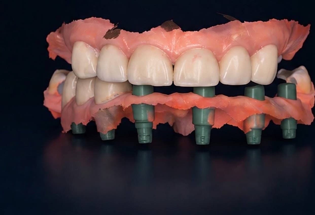 Smile Design